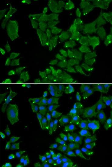 DBN1 / Drebrin Antibody