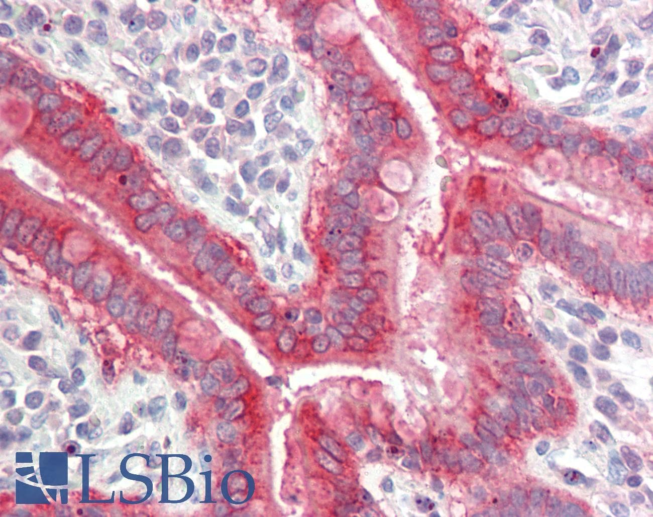 SLC7A8 / LAT2 Antibody (aa63-112)