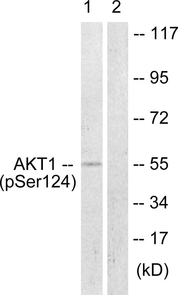 AKT1 Antibody (phospho-Ser124)