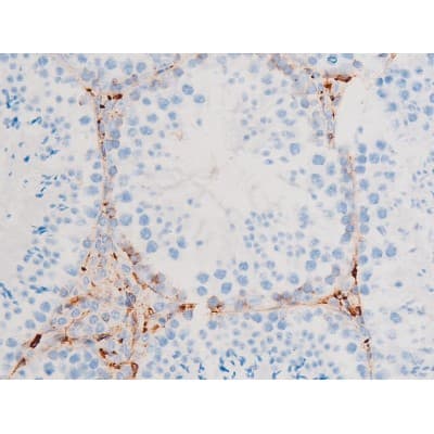 Polyclonal Rabbit anti-Human SYK Antibody (phospho-Tyr348, IHC, IF, WB)
