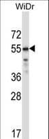 Polyclonal Rabbit anti-Human CRTR1 / TFCP2L1 Antibody (aa222-251, IHC, WB)