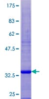 Human SPINK14 Protein (Recombinant GST)