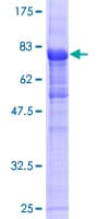 Human HFip1 / FIP1L1 Protein (Recombinant GST)