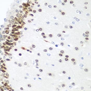 Polyclonal Rabbit anti-Human UBE2U Antibody (IHC, WB)
