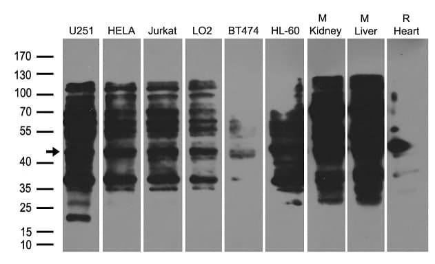 BABAM1 / HSPC142 Antibody
