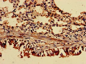 TRIP4 / ASC-1 Antibody