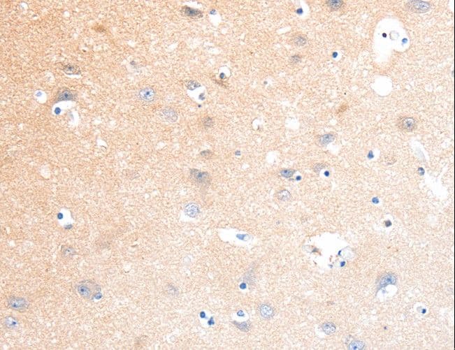 Polyclonal Rabbit anti-Human SLC22A17 Antibody (IHC)