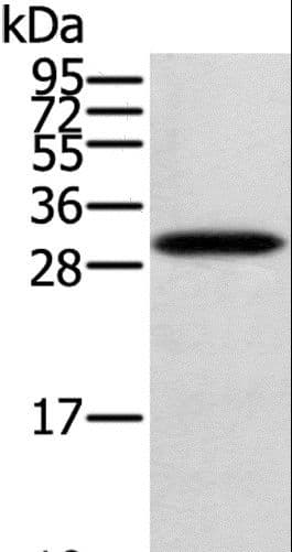 Polyclonal Rabbit anti-Human STARD5 Antibody (IHC, WB)