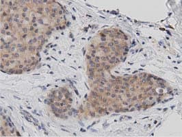 DNAJA2 Antibody (clone OTI3A10)
