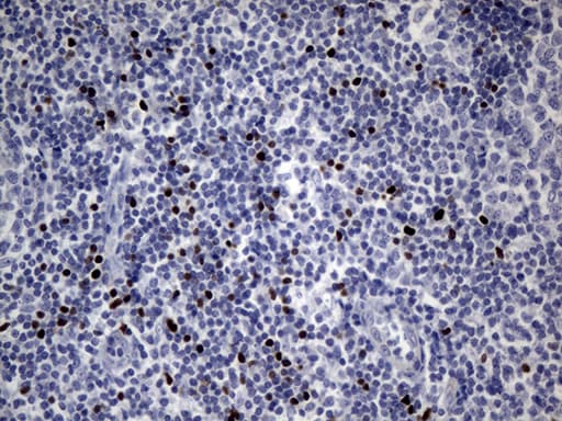 FOXP3 Antibody (clone OTI3D1, Carrier-free)