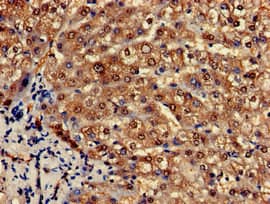 PCCA Antibody