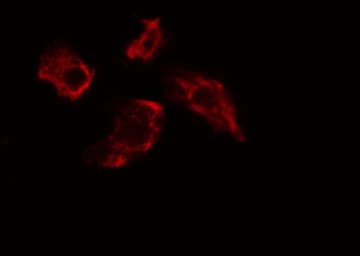 RGS7 Antibody