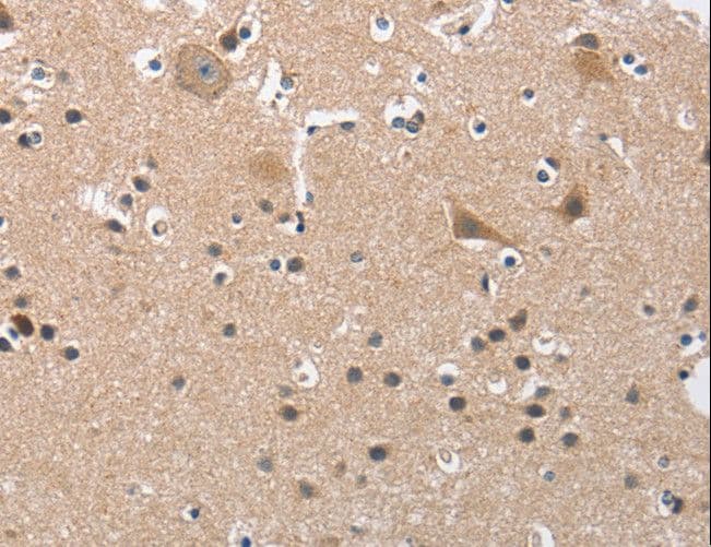 Polyclonal Rabbit anti-Human BUB1 Antibody (IHC)