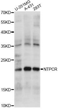 Polyclonal Rabbit anti-Human NTPCR / C1orf57 Antibody (WB)