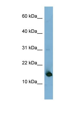 MED31 Antibody (N-Terminus)