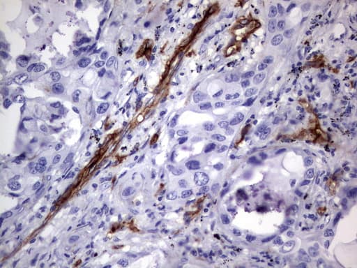 Monoclonal Mouse anti-Human MCAM / CD146 Antibody (clone UMAB155, Carrier-free, IHC, WB)