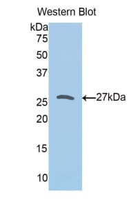 PRDX3 / Peroxiredoxin 3 Antibody (aa5-233, Biotin)