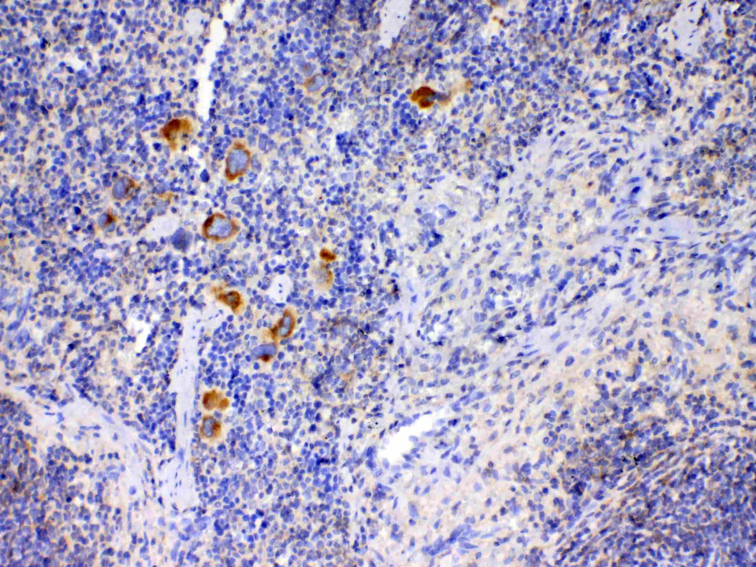 Polyclonal Rabbit anti-Rat IL12A / p35 Antibody (IHC, WB)