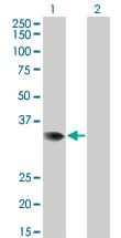 PRPS2 Antibody (clone 4C1)