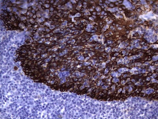 IHC-plus™ Acidic Cytokeratin Antibody (clone 1D10)