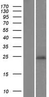 C9orf150 Protein (Over-Expression Lysate Myc-DDK (Flag))