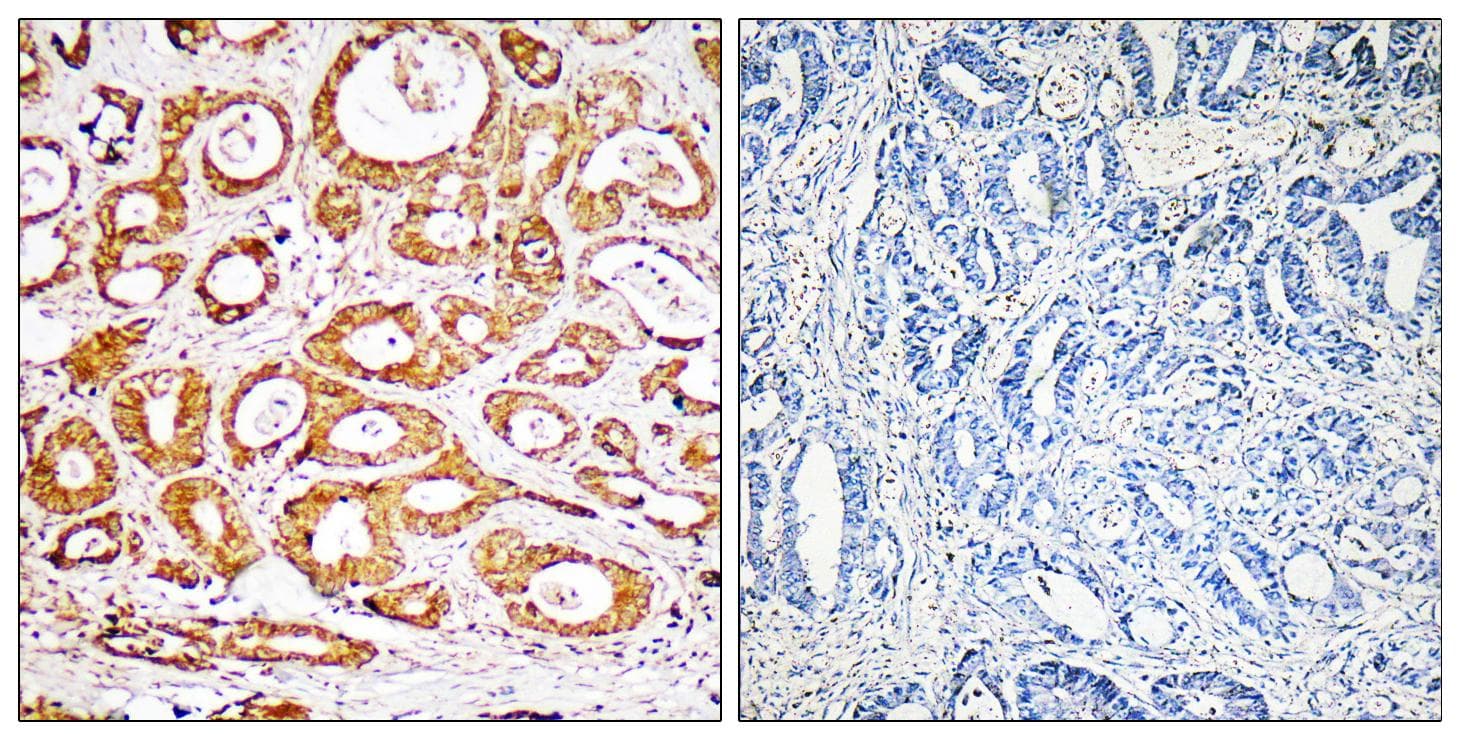 RPS19 / Ribosomal Protein S19 Antibody