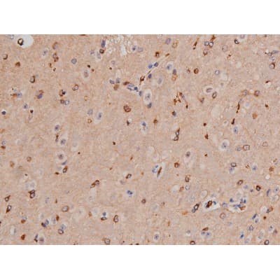 Polyclonal Rabbit anti-Human MAPT / Tau Antibody (phospho-Thr181, IHC, WB)