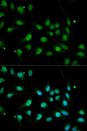 IHC-plus™ Polyclonal Rabbit anti-Human ALK-6 / BMPR1B Antibody (IHC, IF, WB)