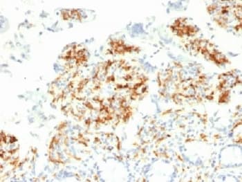 CD209 / DC-SIGN Antibody (clone C209/1781, Azide-free, BSA-free)