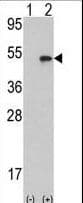 Polyclonal Rabbit anti-Human AURKB / Aurora-B Antibody (aa6-35, IHC, WB)