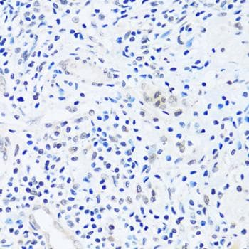 BRIX1 Antibody