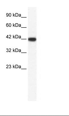 Polyclonal Rabbit anti-Human IBSP / Bone Sialoprotein Antibody (aa108-157, WB)