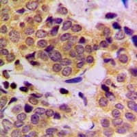 Polyclonal Rabbit anti-Human PTPN11 / SHP-2 / NS1 Antibody (phospho-Tyr542, IHC, WB)