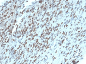 Monoclonal Mouse anti-Human TLE1 / TLE 1 Antibody (clone TLE1/2062, IHC, WB)
