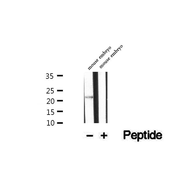 Polyclonal Rabbit anti-Human UBE2E2 / UBCH8 Antibody (IHC, WB)