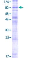 Human SLC17A7 / VGLUT1 Protein (Recombinant GST)