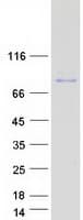 Human TIGD4 Protein (Recombinant Myc-DDK (Flag))