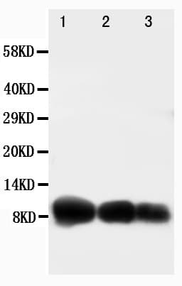 Polyclonal Rabbit anti-Human CXCL10 / IP-10 Antibody (aa79-98, IHC, WB)