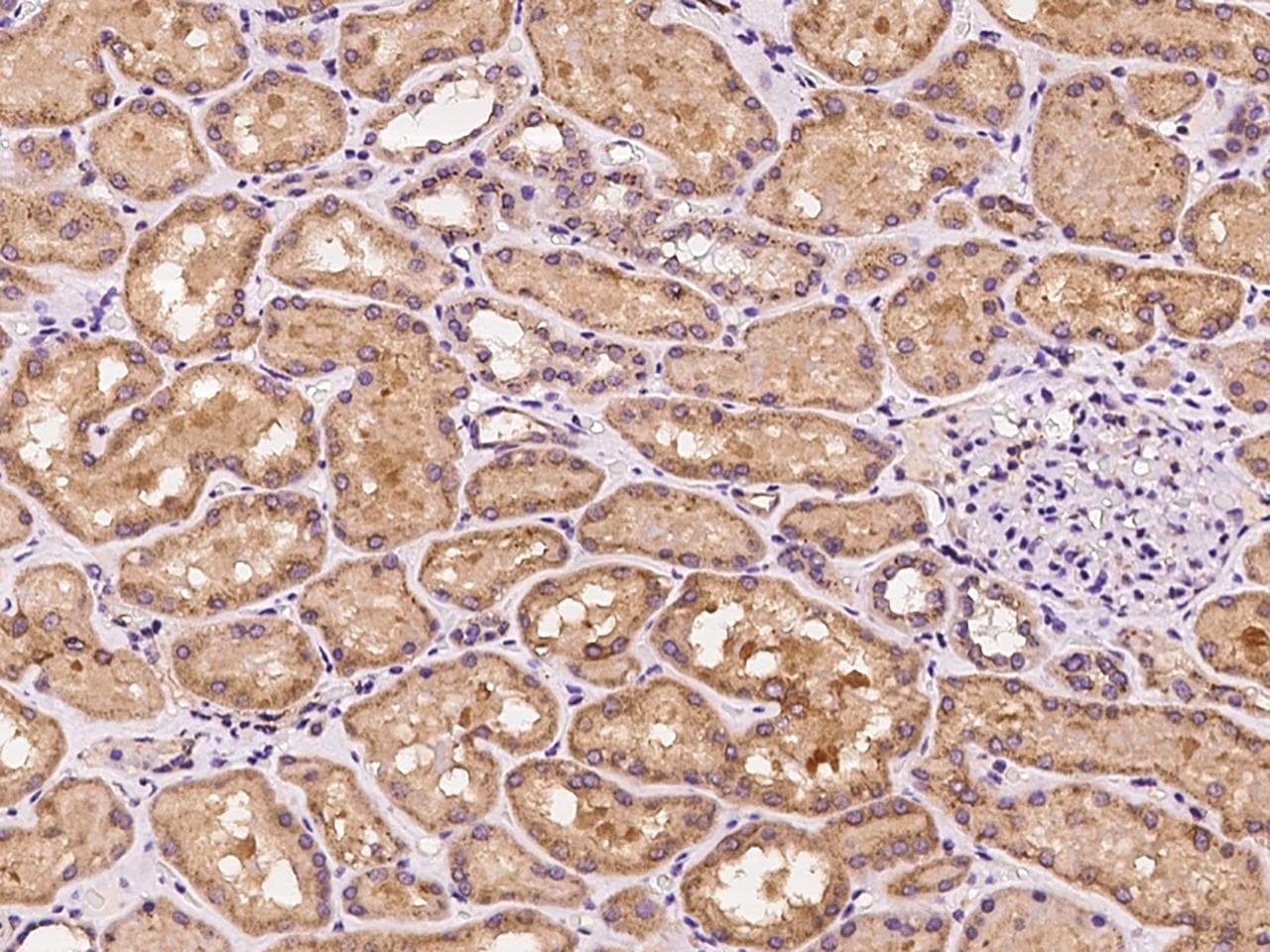 Polyclonal Rabbit anti-Human SLC25A42 Antibody (IHC, IF)