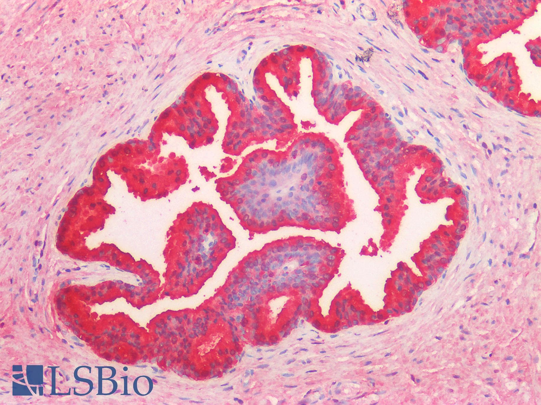 IHC-plus™ Polyclonal Goat anti-Human KLK3 / PSA Antibody (IHC, WB)