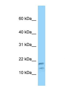 DBI / ACBD1 Antibody (N-Terminus)