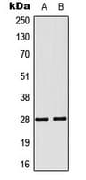 NKX2-6 Antibody (Internal)