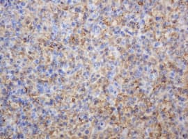 TP / Thymidine Phosphorylase Antibody (aa311-482, clone 7A6, Carrier-free)