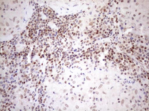 Monoclonal Mouse anti-Human MGMT Antibody (clone OTI2F10, IHC, WB)