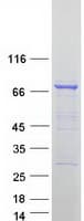Human DYNC1I1 Protein (Recombinant Myc-DDK (Flag))