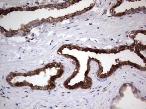 LGALS3 / Galectin 3 Antibody (clone OTI9C7)