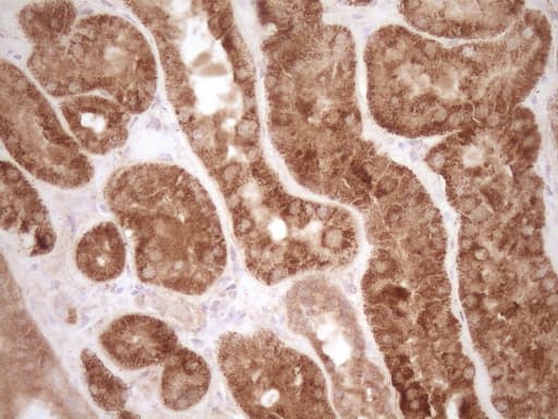 Monoclonal Mouse anti-Human MMP3 Antibody (clone OTI1E9, aa246-477, IHC, WB)