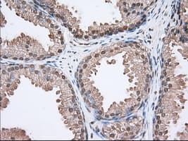 ACAT2 Antibody (clone OTI5F7)