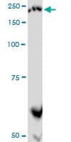 PLXNA2 / Plexin A2 Antibody (clone 2G5)