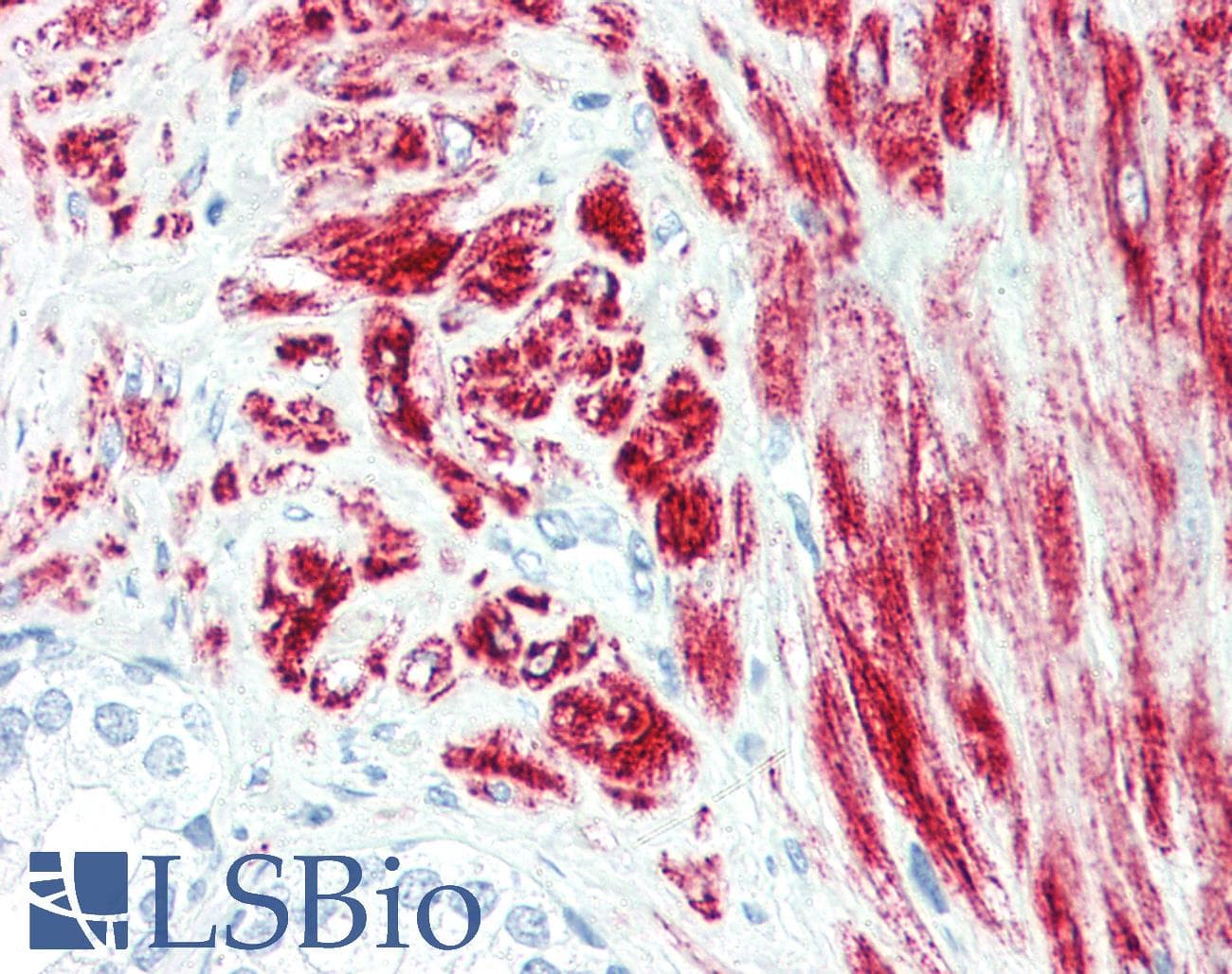 IHC-plus™ DES / Desmin Antibody